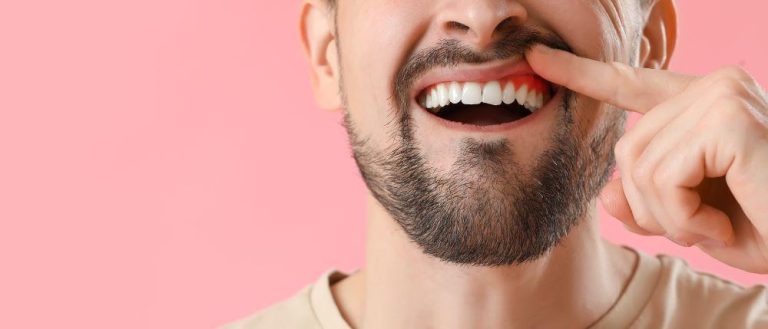Ist Es Schlimm Wenn Ein Stück Zahn Abbricht yessmile.de