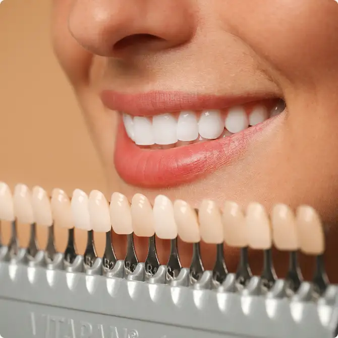 Bild zeigt eine Frau, die vor einer Farbenpalette von Veneers von YesSmile ihre weißen Zähne lächelnd zeigt