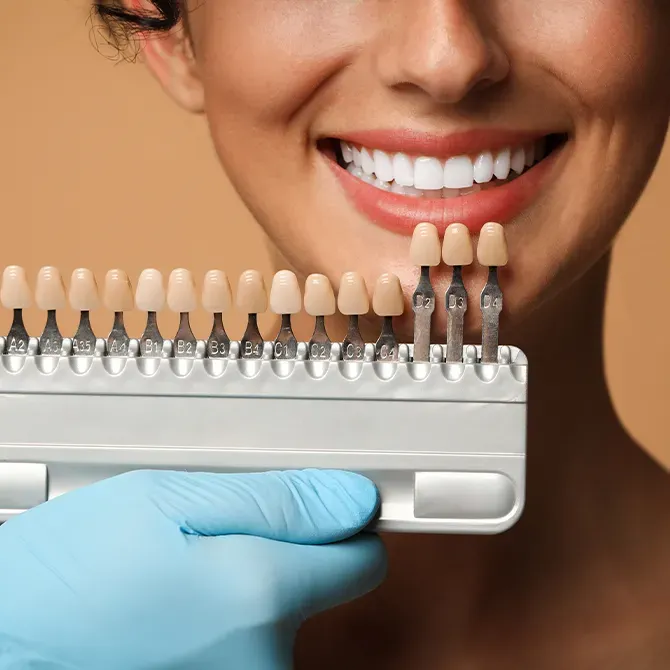 Arzt hält Farbpalette von Veneers an die Zähne einer YesSmile Patientin