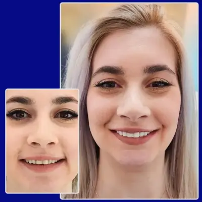 Vorher Nachher Vergleich Veneers von YesSmile Patientin Rasima