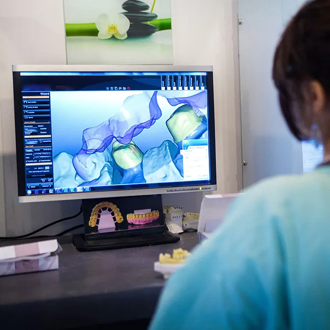 Bild zeigt YesSmile Patienten beim 3D-Scan der NPS Technik