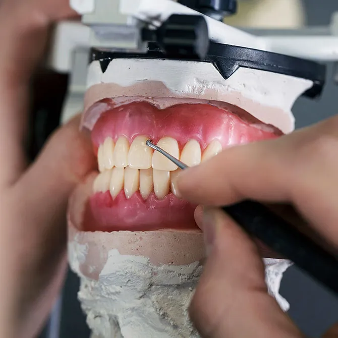 Bild zeigt YesSmile Zahntechniker bei der Zahnglasur als Teil der NPS Technik