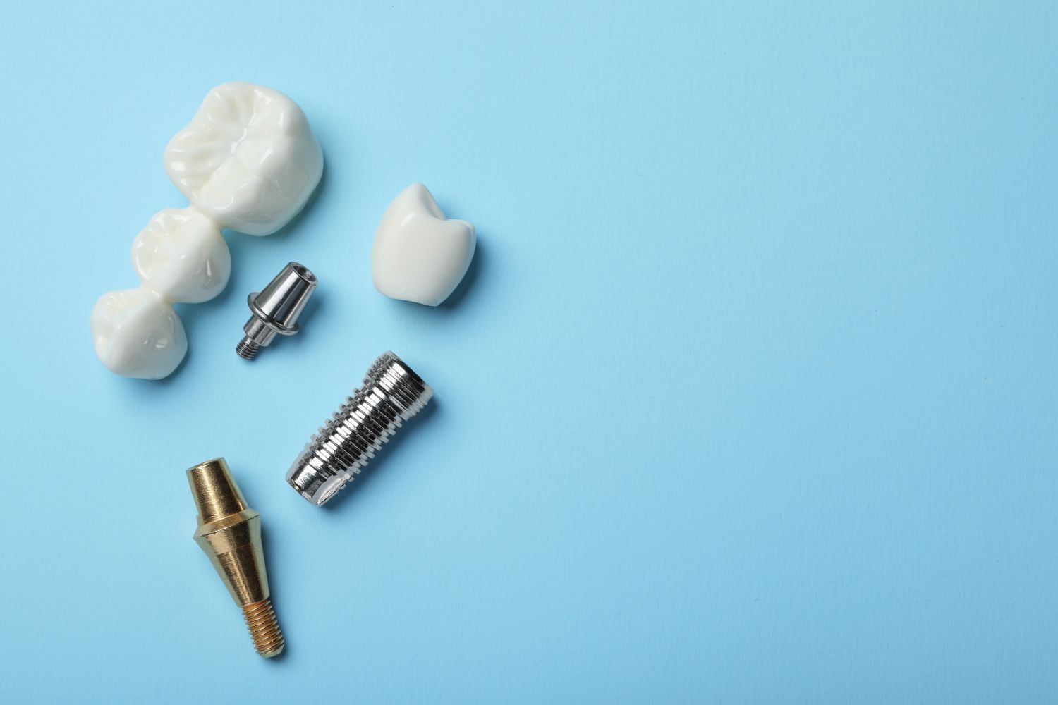 Implantat oder Brücke
